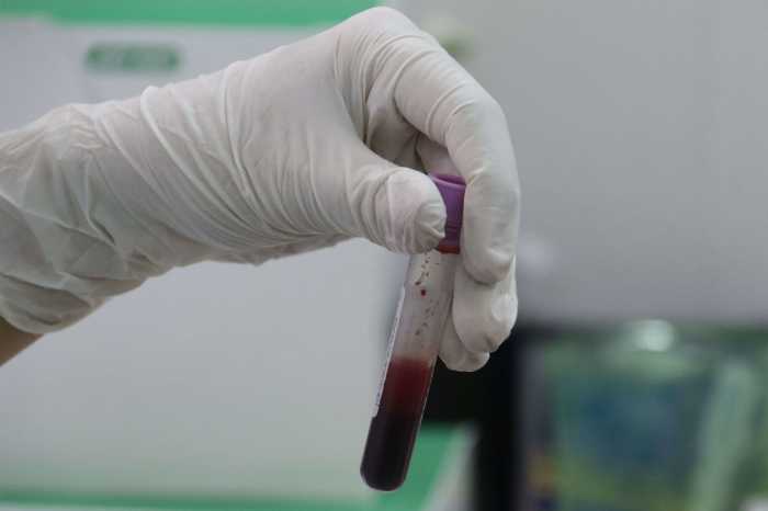 Estado de Nueva York aspira acabar con la epidemia de VIH en 2020