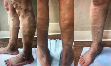 Tratamiento vascular para hombres y mujeres en Delmont Medical Care