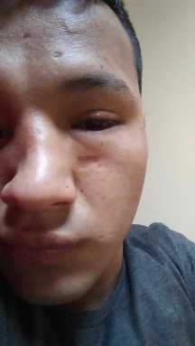 Hispano gay sufre atroz ataque homofóbico en Queens