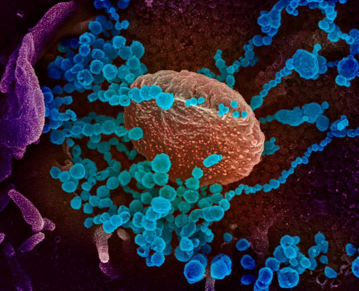 Coronavirus en Nueva York: Primer caso positivo confirmado en Manhattan