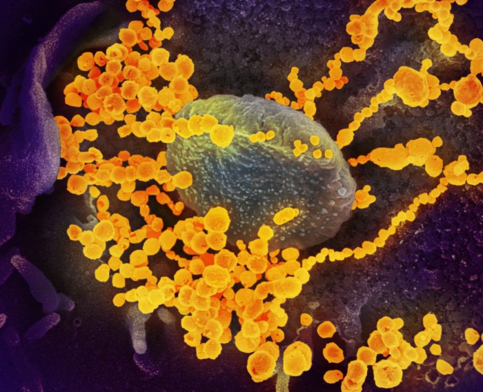 Los CDC piden prepararse para el coronavirus que se propagará por EEUU