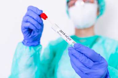 Conoce las principales pruebas para detectar el Coronavirus