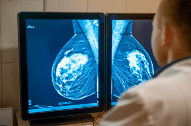 ¿Qué tipo de cáncer de mama tiene el peor pronóstico y riesgo de muerte?