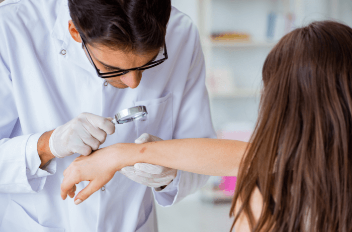 Importancia de usar protector solar para evitar el cáncer de piel