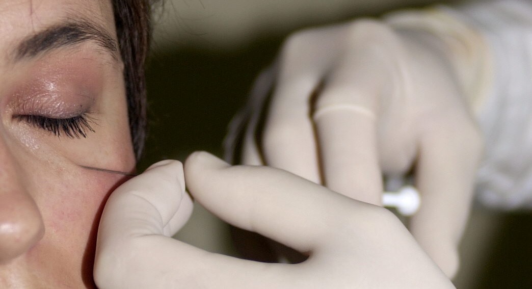 Al menos 19 mujeres en Nueva York y otros 8 estados enferman tras recibir inyecciones de bótox