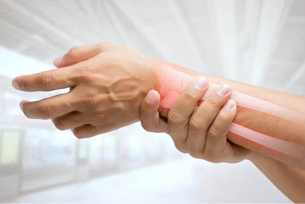Como las mujeres pueden mantener la salud ósea y prevenir caídas