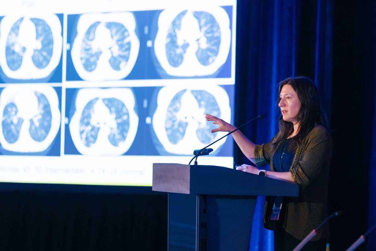 La infección pulmonar oculta que afecta a millones de personas