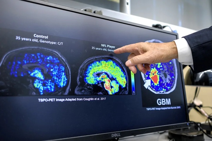 Noviembre es el Mes de la concientización sobre la enfermedad de Alzheimer y Mes nacional de cuidadores familiares