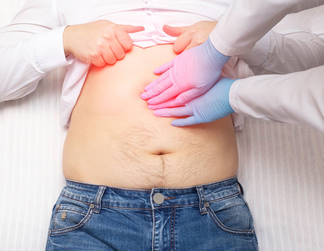 Factores de riesgo y prevención del cáncer de páncreas que afecta a latinos